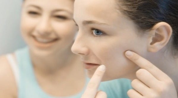 getting rid of acne scars