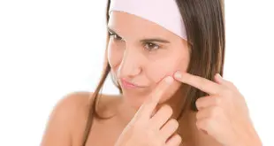 How to Remove Acne Marks Fast