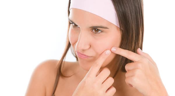 How to Remove Acne Marks Fast