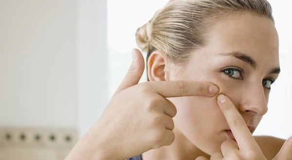 Unusual Acne Causes