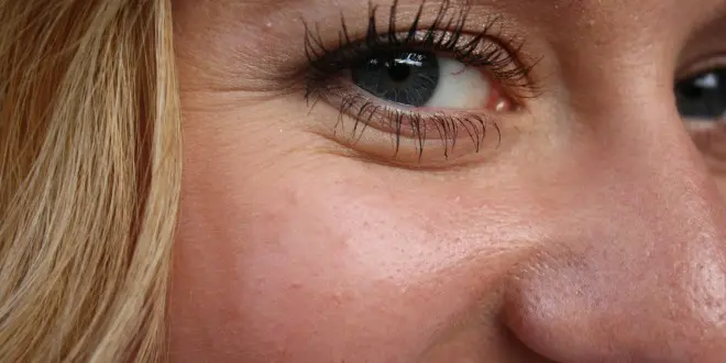 facelift procedure
