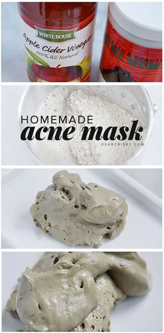 diy acne mask