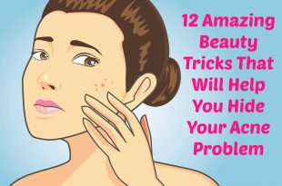 12 Amazing Beauty Tricks That Will Help You Hide Your Acne Problem